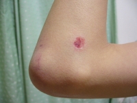 20140118_bicycle_accident_03.jpg