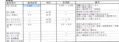 20120514尿2