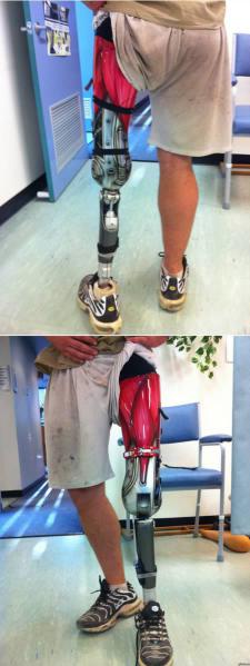 a98359_prosthectics_8-cyborg.jpg