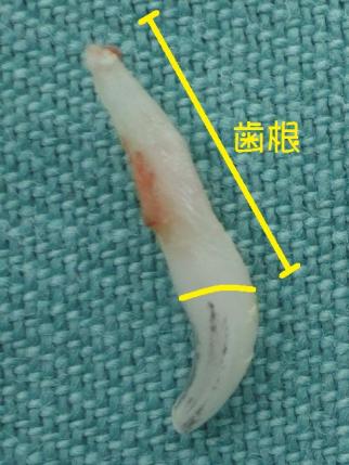 抜いた乳歯