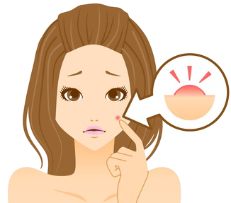 にきび痕に悩む女性