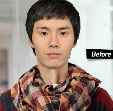 Id病院 男性の美容整形 コリアbeautyナビ 韓国での美容 整形 歯科 漢方 観光情報満載