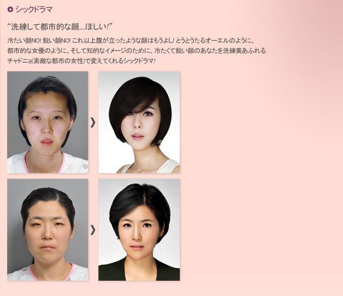 シンデレラ整形外科の症例写真 コリアbeautyナビ 韓国での美容 整形 歯科 漢方 観光情報満載