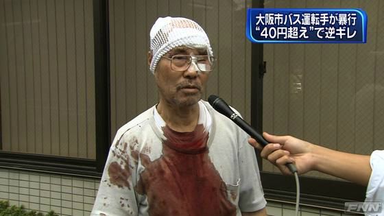 大阪市営バスの運転手 タクシー運転手をボコボコに殴ったとして逮捕 時事問題が多かったブログ