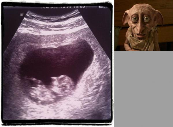 pregnant_xrays_01.jpg