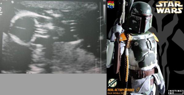 pregnant_xrays_02.jpg