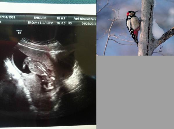 pregnant_xrays_03.jpg