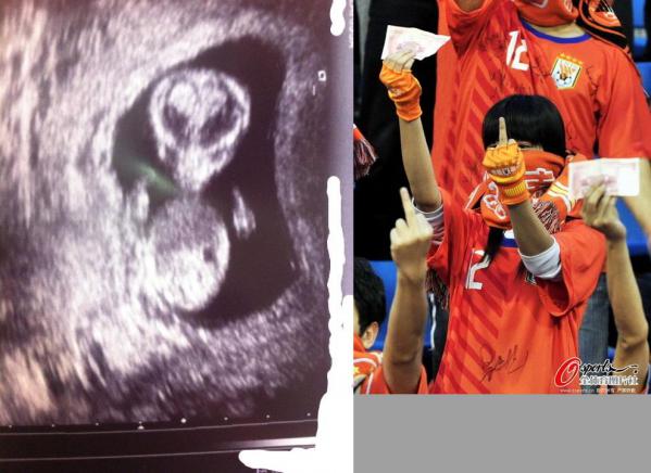 pregnant_xrays_04.jpg