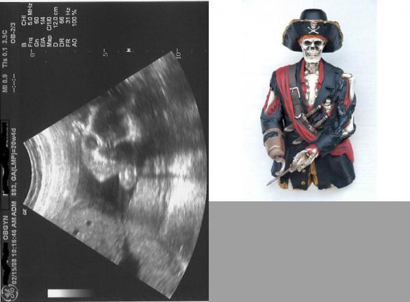 pregnant_xrays_05.jpg