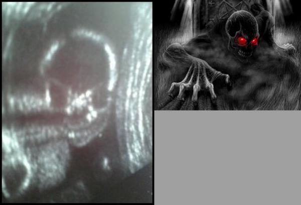 pregnant_xrays_06.jpg