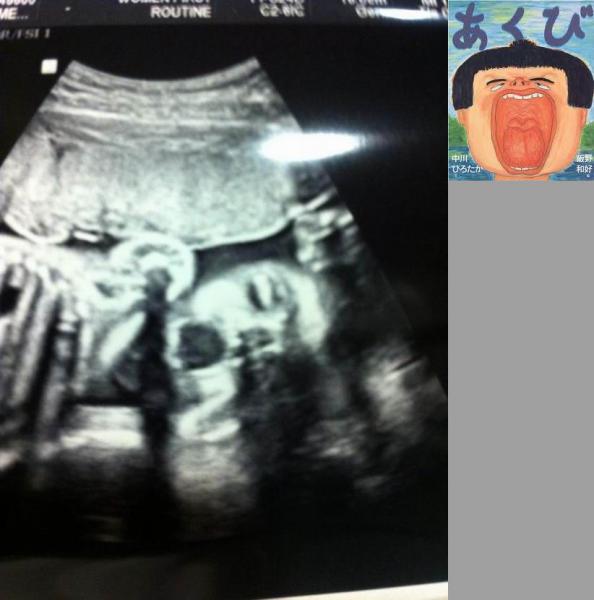 pregnant_xrays_07.jpg