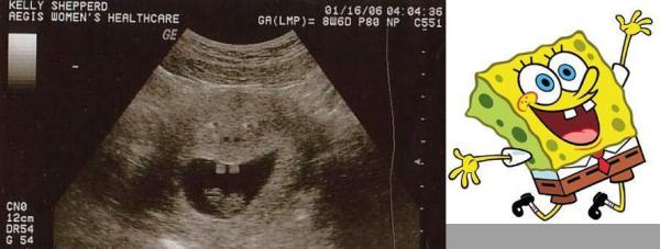 pregnant_xrays_09.jpg