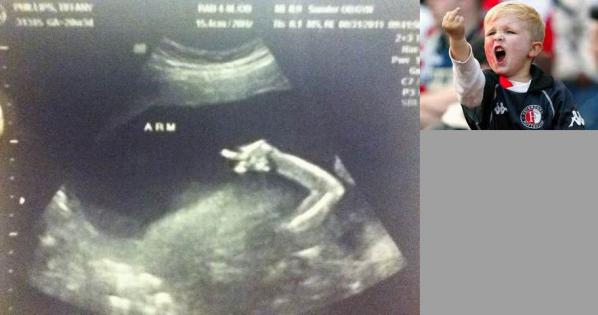 pregnant_xrays_10.jpg