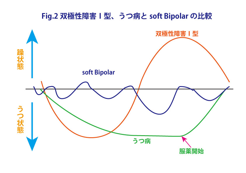 bipolar2.jpg