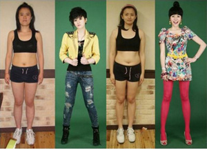 crazy_before_and_after_photos_of_korean_plastic_01.jpg
