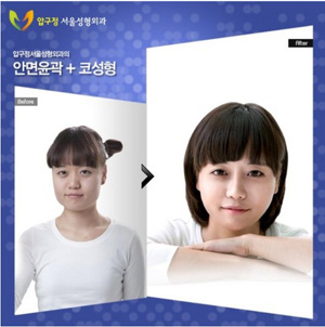 crazy_before_and_after_photos_of_korean_plastic_12.jpg