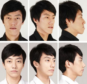 crazy_before_and_after_photos_of_korean_plastic_14.jpg