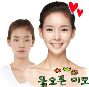 crazy_before_and_after_photos_of_korean_plastic_18.jpg
