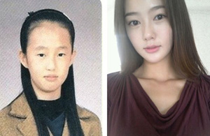 crazy_before_and_after_photos_of_korean_plastic_21.jpg