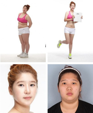 crazy_before_and_after_photos_of_korean_plastic_23.jpg