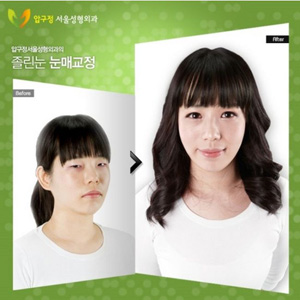 crazy_before_and_after_photos_of_korean_plastic_29.jpg