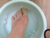 痛風の左足を氷水で冷やす、